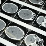 Dlaczego teleradiologia staje się standardem w nowoczesnej diagnostyce?