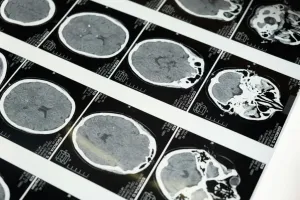 Dlaczego teleradiologia staje się standardem w nowoczesnej diagnostyce?
